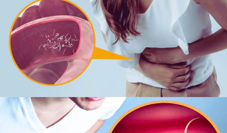 10 Common Signs that your body is full of Dangerous Parasites (Intestinal Worms)