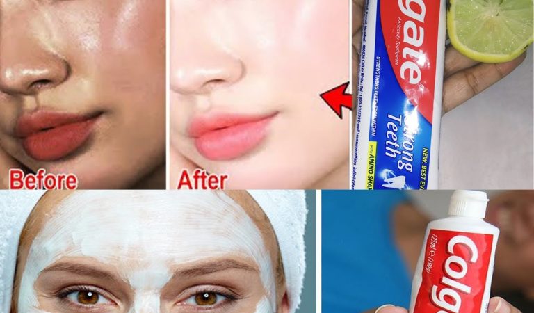 Colgate toothpaste for face whitening | Lemon and colgate