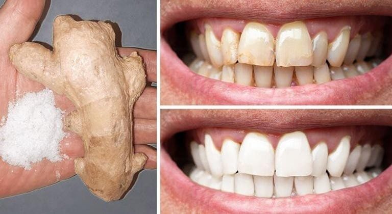 Whiten Your Teeth in 2 Minutes – Home Remedy with Ginger & Salt