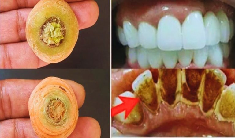 Whiten Dirty Teeth Like Pearls in 2 Minutes: Carrot Tops Home Remedy