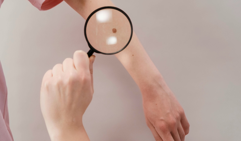 Doctor reveals two little-known signs of skin c-ancer that everyone misses
