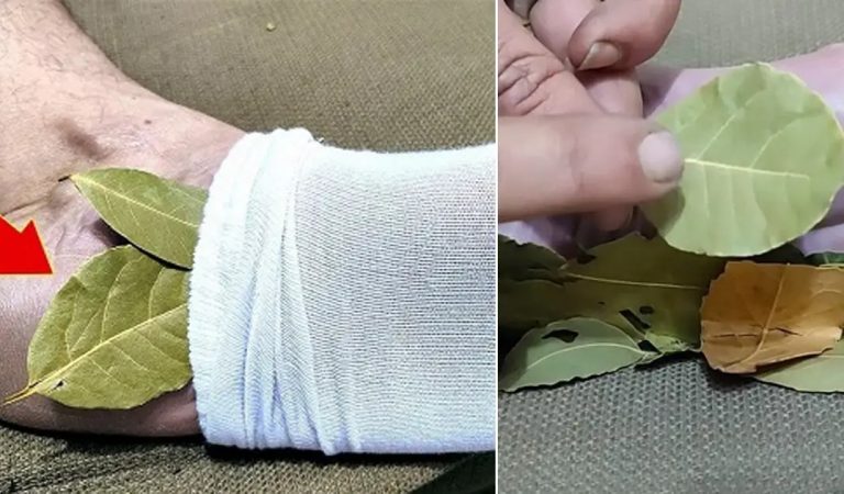 Discover the Surprising Benefits of Putting a Bay Leaf in Your Socks